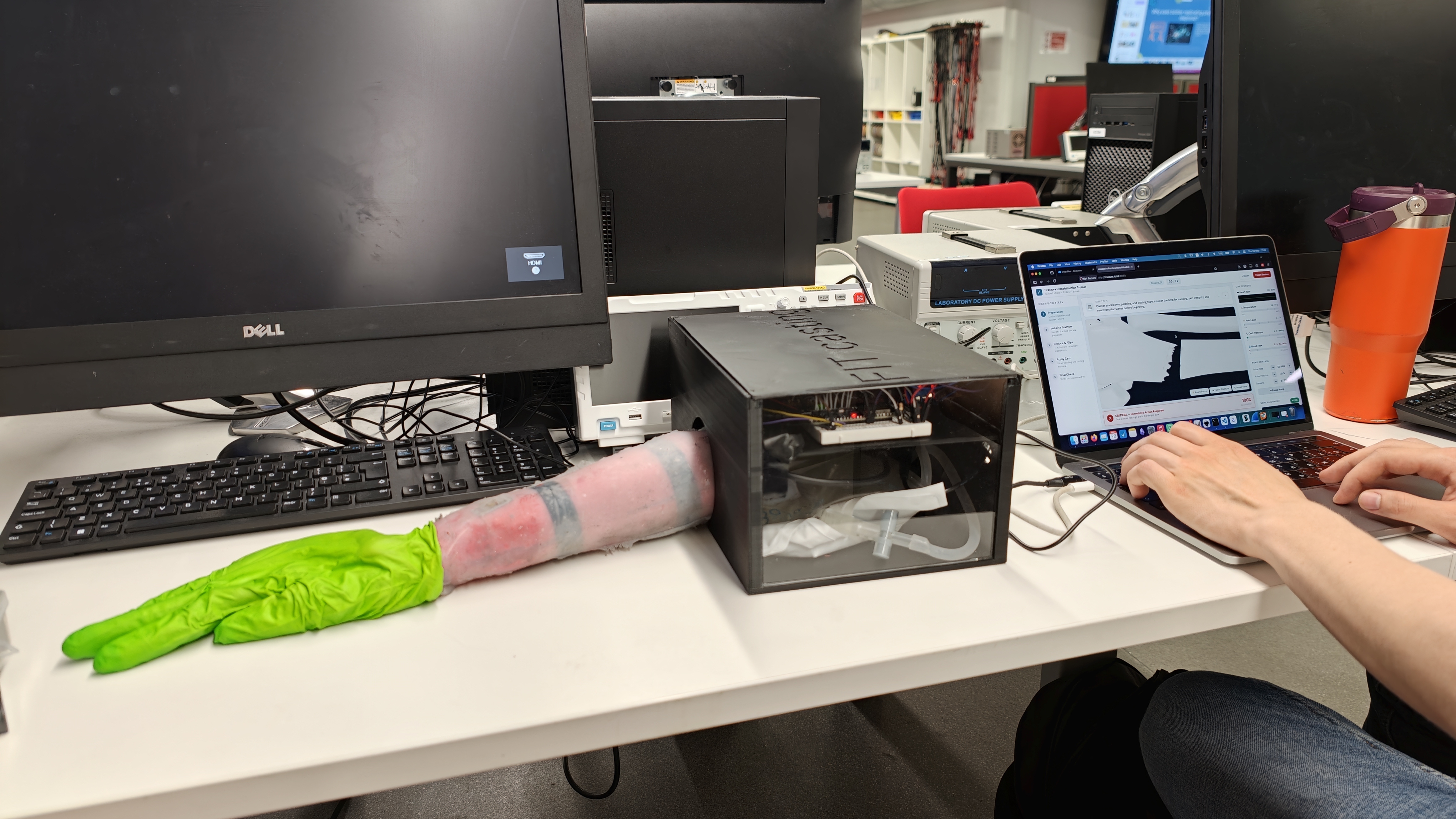 Completed fracture immobilisation trainer on the lab bench, with the anatomical forearm attached to the FIT casing and connected to a laptop